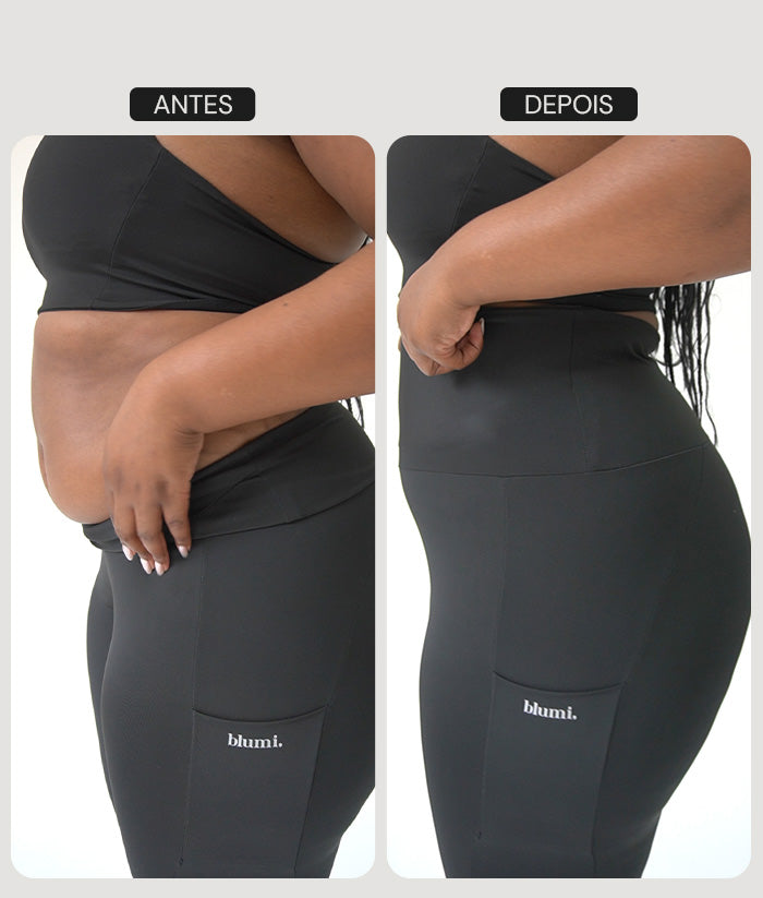 Legging Recovery